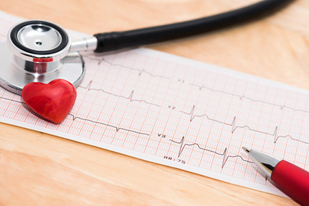 An EKG heart monitor printout with a stethoscope