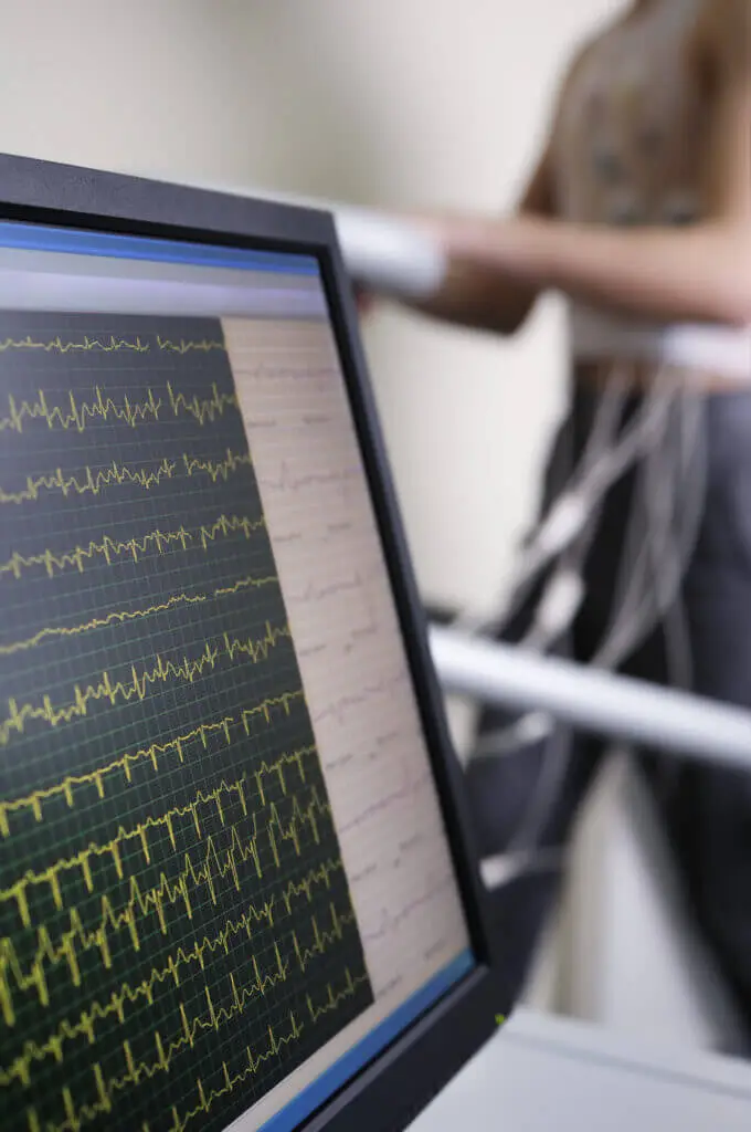 a computer screen showing heart beats on a treadmill as part of an exercise stress test